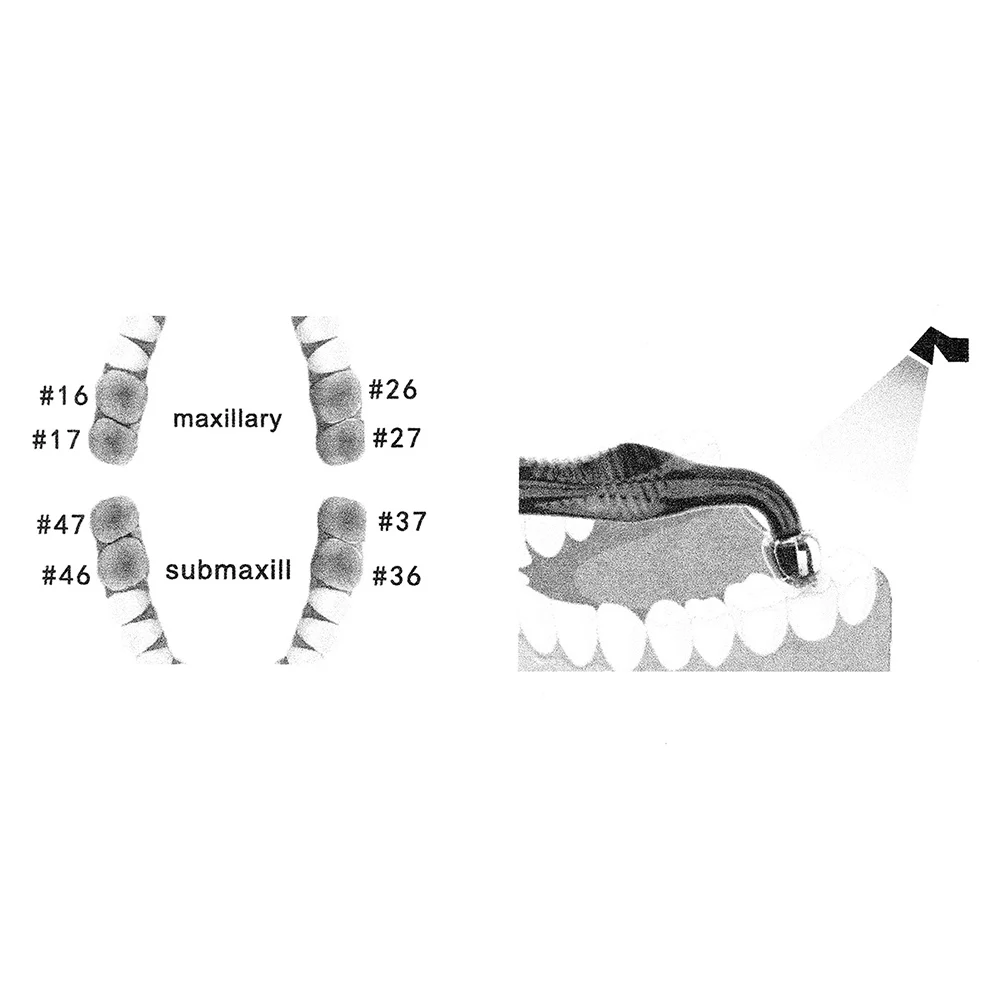 Dental Orthodontic Posterior T – 3D Printing Orthodontics recenzja i cena